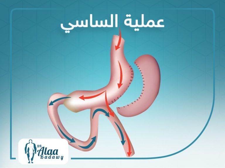 عملية الساسي