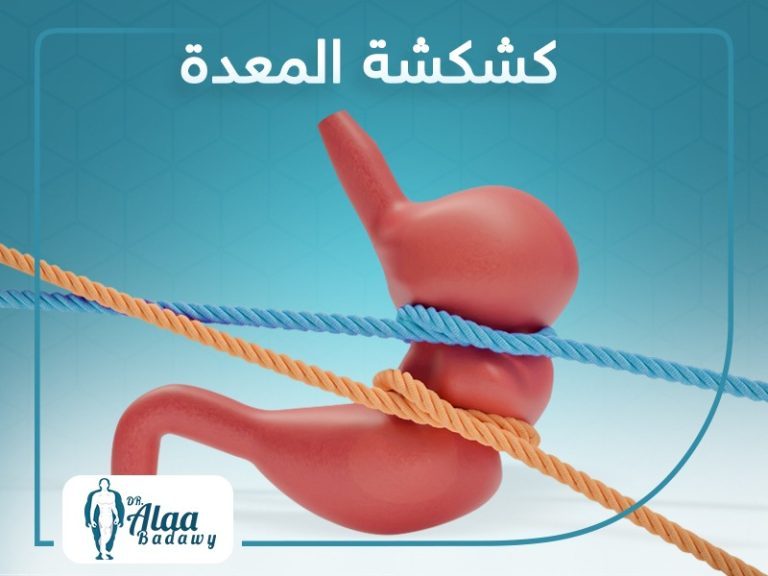 عملية كشكشة المعدة